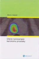 Cílená radioterapie karcinomu prostaty Nucleus HK