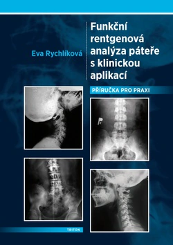 Funkční rentgenová analýza páteře s klinickou aplikací Triton