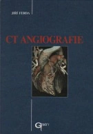 CT angiografie Galén CT angiografie Galén