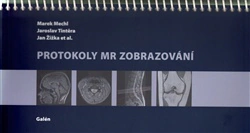 Protokoly MR Zobrazování Galén Protokoly MR Zobrazování Galén