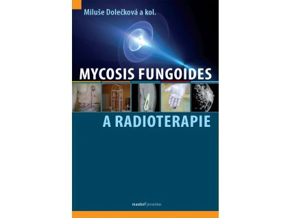 Mycosis fungoides a radioterapie Maxdorf