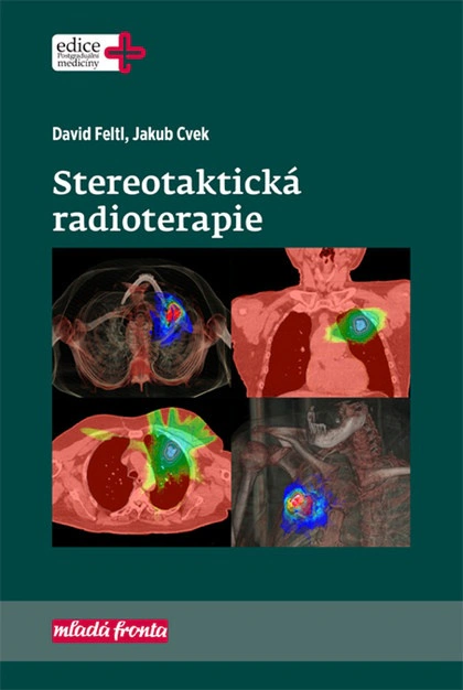 Stereotaktická radioterapie Mladá fronta