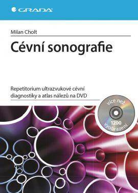 Cévní sonografie - repetitorium ultrazvukové cévní diagnostiky a atlas nálezů na DVD Grada Cévní sonografie - repetitorium ultrazvukové cévní diagnostiky a atlas nálezů na DVD Grada
