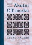 Akutní CT mozku. Atlas nálezů Univerzita Palackého v Olomouci
