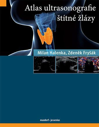 Atlas ultrasonografie štítné žlázy Maxdorf Atlas ultrasonografie štítné žlázy Maxdorf