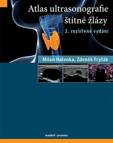 Atlas ultrasonografie štítné žlázy, 2. rozšířené vydání Maxdorf Atlas ultrasonografie štítné žlázy, 2. rozšířené vydání Maxdorf