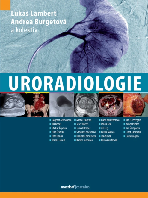 Uroradiologie Maxdorf Uroradiologie Maxdorf
